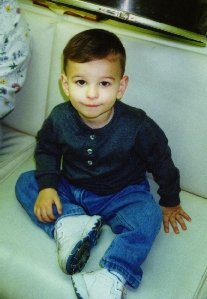 Johnny, right after he was scalped